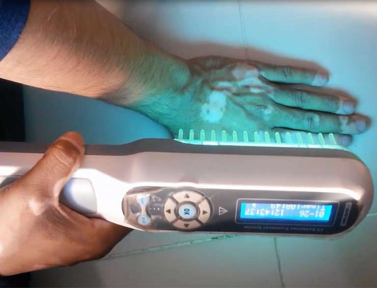 Photo Therapy/Light Therapy