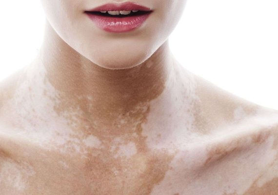 8f1647bf815b466b9c77c67859b4c3fd